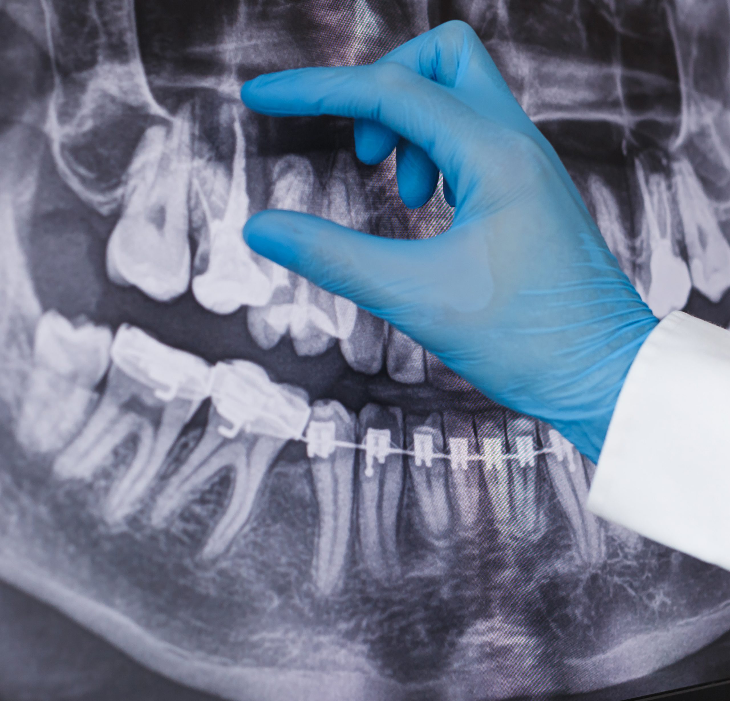 radiologie dentară Sibiu